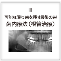 可能な限り歯を残す最後の砦歯内療法（根管治療）